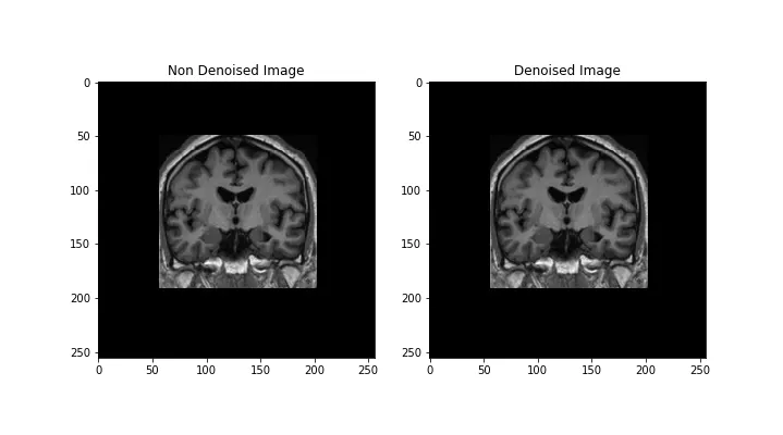 Figure1 from Filtering the Images.