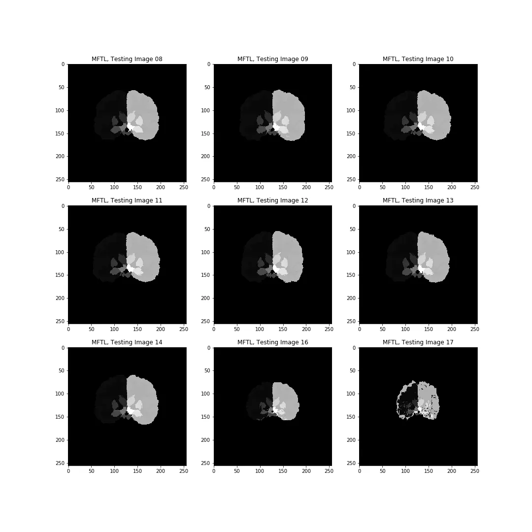Figure2 from Filtering the Images.